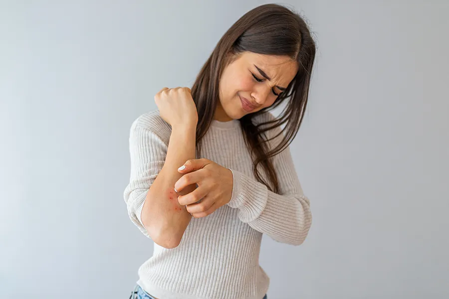 Eczema-Clinic A young brunette woman scratches her forearm and winces in discomfort. Get treatment for eczema from Dr. Stephanie King in Salt Lake City.