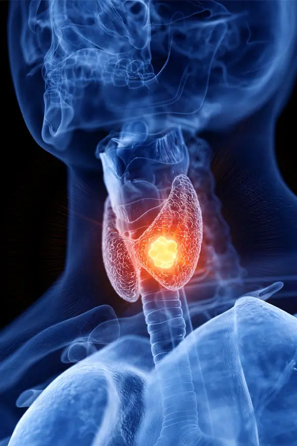 Thyroid-Imbalance-Treatment A 3D illustration of an x-ray of a human neck, highlighting the thyroid. Get help with thyroid imbalance from Dr. Stephanie King in Salt Lake City.